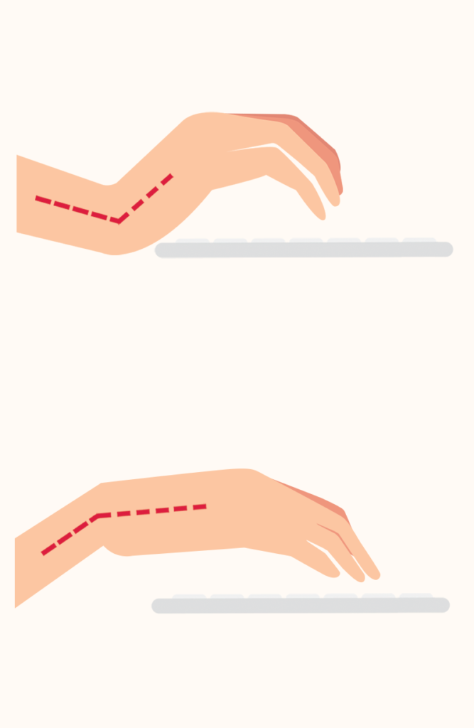 Hands with poor posture bent up and down over keyboard